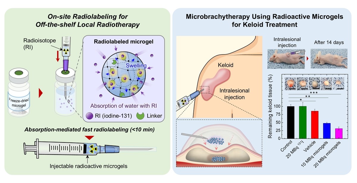 South Korean team develops biodegradable microgel for localized radiation therapy