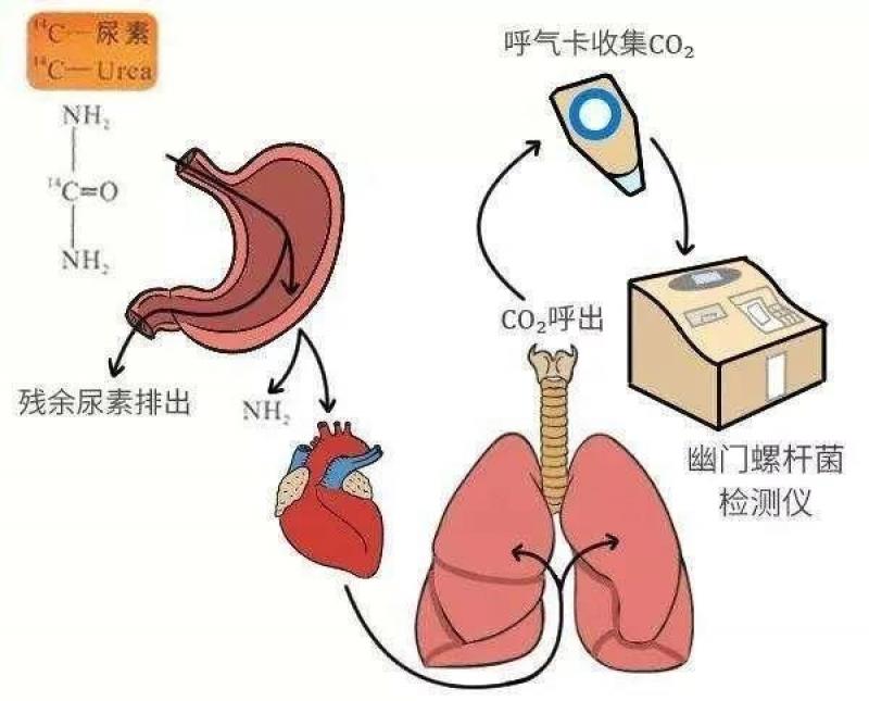 幽门螺杆菌检测与商用核反应堆居然有关联?