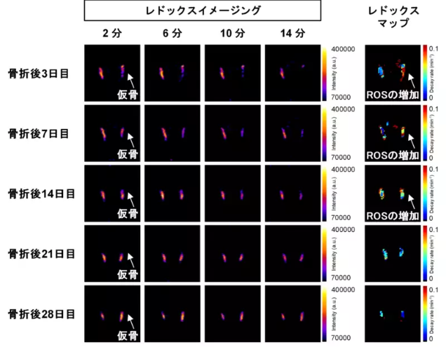 Une équipe de recherche japonaise visualise les changements métaboliques cellulaires lors de la cicatrisation osseuse par IRM hyperpolarisée